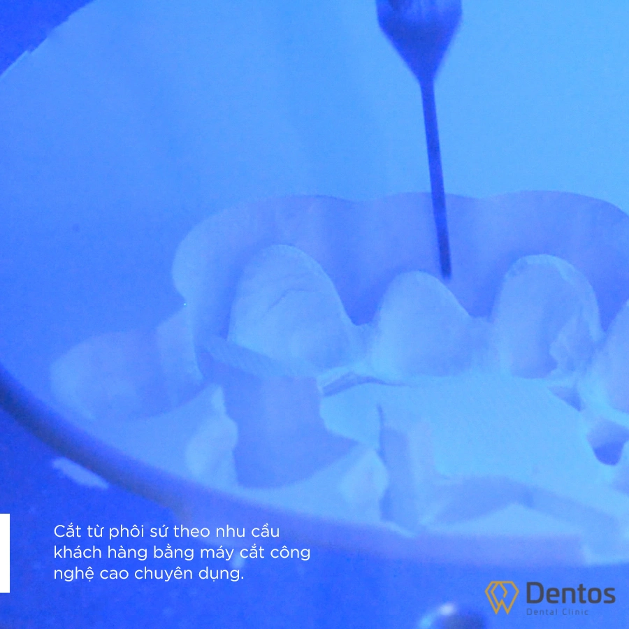 Chế tác răng sứ bằng công nghệ CAD/CAM tại Labo Dentos